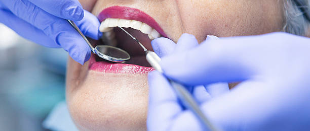 Best Broken Tooth Emergency  in Veedersburg, IN